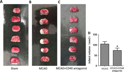 Infarct Volume After Transient Middle Cerebral Artery Occlusion Mcao