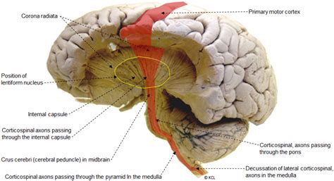 The Internal Capsule Lateral View Showing Corticospinal Pathway