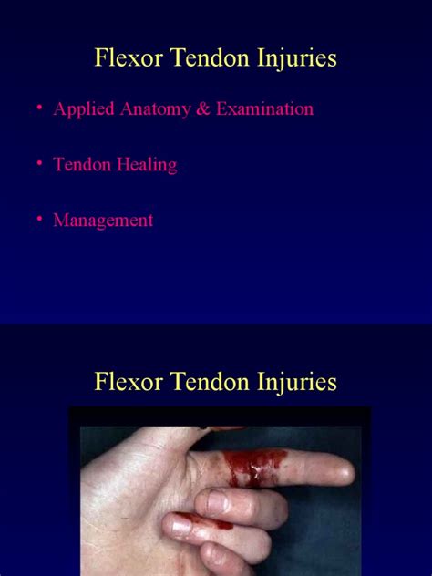 Pdf Flexor Tendon Injuries Dokumen Tips