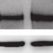 Representative Immunoblot And Densitometric Analysis Of Hypoxia