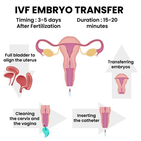 IVF PROCESS Step By Step Guide Arpanu Medical