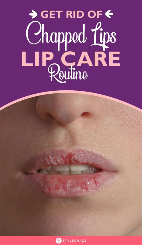 Say Good Bye To Chapped Lips With This Lip Care Routine Lip Care Routine Lips Lip Care