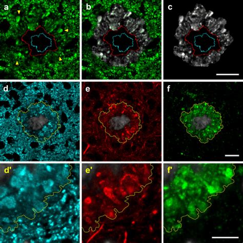 A The Boundary Between Synaptophysin Immunoreactive Dystrophic