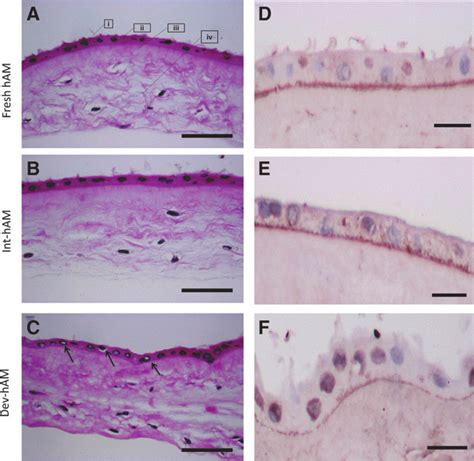 Hematoxylin And Eosin Hande And Collagen Iv Col Iv Staining Of Human