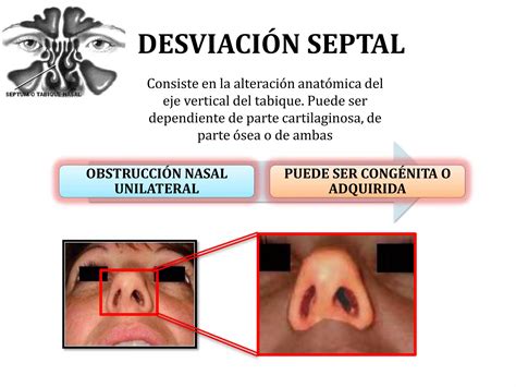 Anatomía de las fosas nasales y los senos paranasales PPT