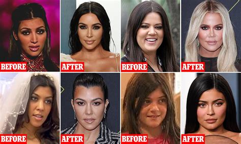 Kourtney Kardashian Face Change