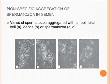 Semen Analysis In Fertility Management