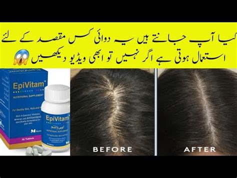 Epi Vitam Tablets Review Multivitamins For Hair Fall In Urdu Stop