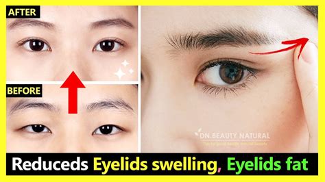 How To Reduce Eyelids Swelling And Eyelids Fat Make Eyes Bigger Naturally Japan Eyes Massage