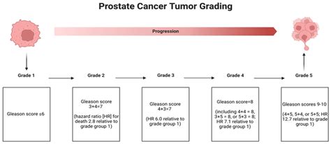 PCa Tumor Grading Using The Gleason And ISUP Grading System Created