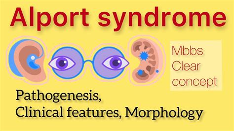 Alport Syndrome Pathogenesis Clinical Features Morphology YouTube