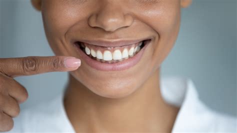 Cirugía de la Sonrisa Gingival Todo lo que debes saber