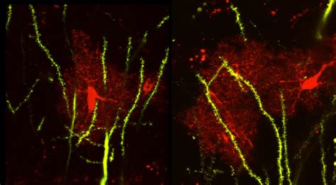 Astrocytes And Neurons Image Eurekalert Science News Releases