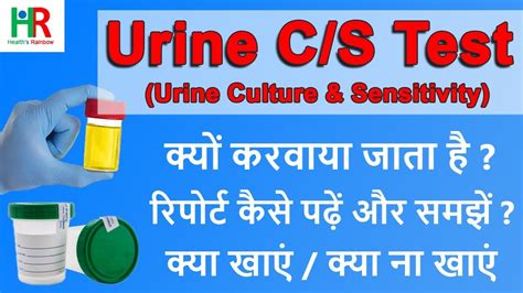 Urine Culture Test