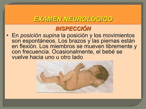 Examen Neurologico Del Recien Nacido Ppt