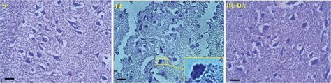 The Photomicrographs Illustrating The Cresyl Violet Stained Coronal