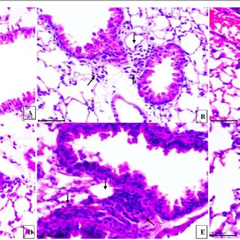 H E Staining Paraffin Section Of Lung Showing Normal Alveolar