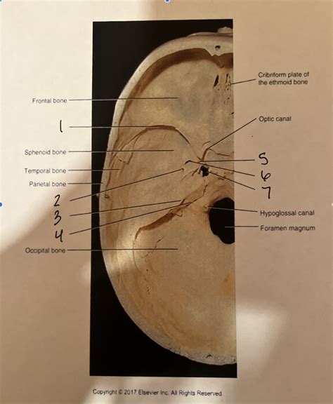 Foramina Of The Internal Skull Diagram Quizlet