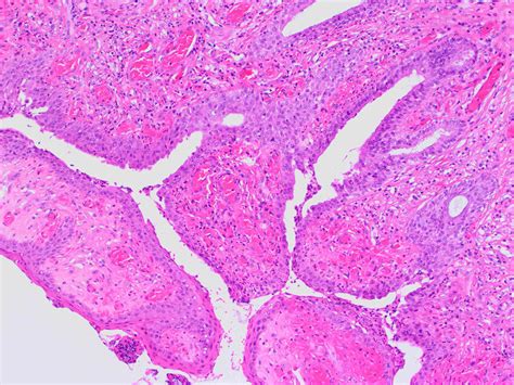 Histology of the specimen. Structure of skeletal muscle tissue ...