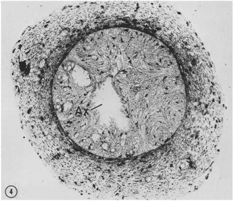 Light Microscope Autoradiograph Of A Cross Section Of The Right