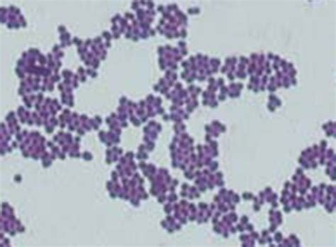 √100以上 E Coli Morphology Gram Stain 283207 Li Gram Stain Morphology And Arrangement