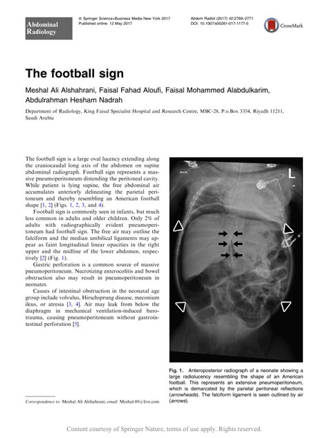 The Football Sign Request Pdf