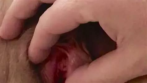 Delicious Hairy Pussy American Milf Nude Pics Xhamster