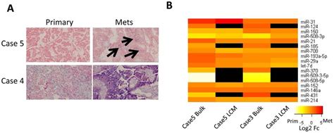 Validation Of Mirna Expression A In Situ Hybridization Of Mir 21