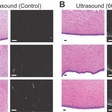 Representative Images Showing The Anterior Cornea Epithelium Corneas