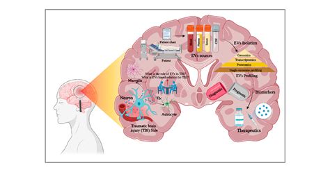 Clinical Theragnostic Signature Of Extracellular Vesicles In Traumatic