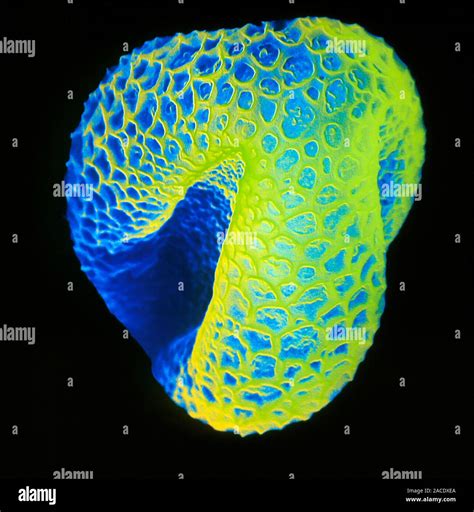 Willow Pollen Coloured Scanning Electron Micro Graph Sem Of A