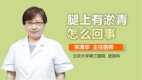 莫名奇妙腿上有淤青是怎么回事 有来医生