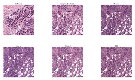 Comparison Of Stain Normalization Techniques On A Sample Training