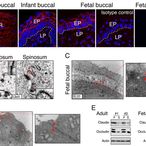 Detection Of Tight Junction Proteins In Adult Infant And Fetal Oral