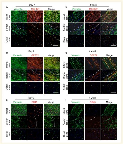 Expression Of Hsd B And Gfpt In Cardiac Fibroblast Upon Myocardial