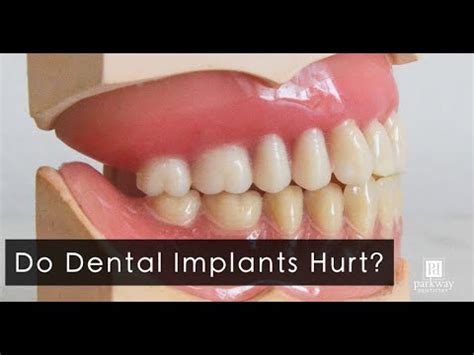 The Dental Implants Experience Do Dental Implants Hurt Dental Clinic