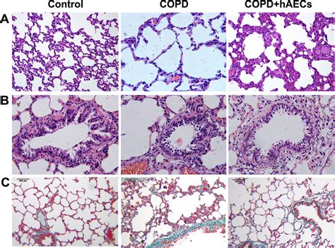 Pulmonary Histopathology A H E Staining Of Lung Tissues Of Rats In