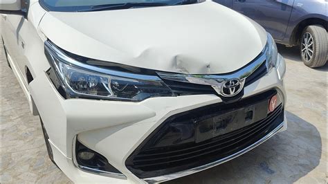 Toyota Corolla Hood Dry Dent Remove Youtube