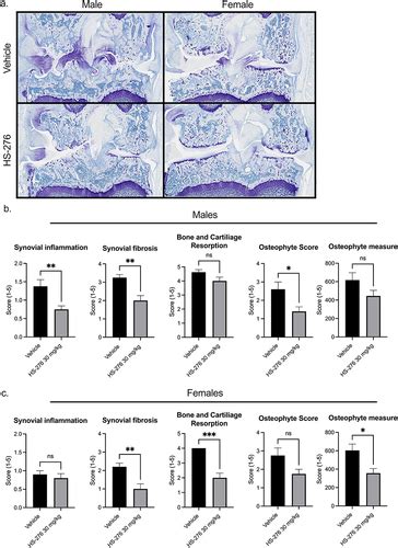 Full article Transforming Growth Factor β Activated Kinase 1 TAK1