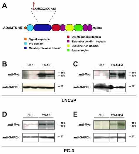 Enforced Expression Of ADAMTS 15 And ADAMTS 15EA In Prostate Cancer