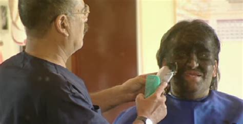 “People Only Know Me as a Freak,” The Wolf Man Struggles to Find a Job ...