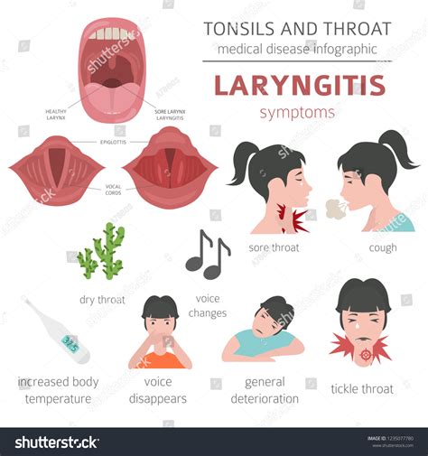 Tonsils Throat Diseases Laryngitis Symptoms Treatment Stock Vector ...