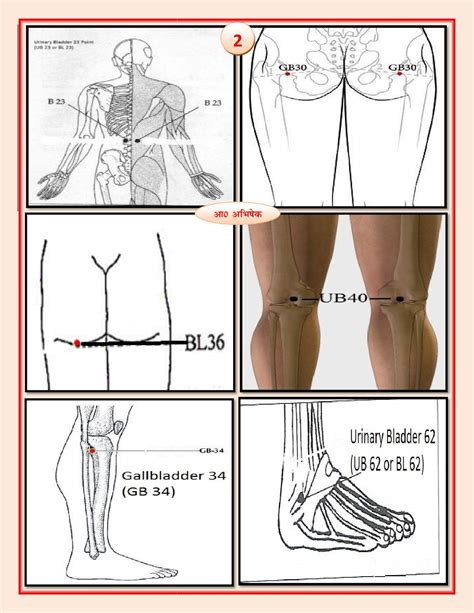 Sciatica Pain Chart