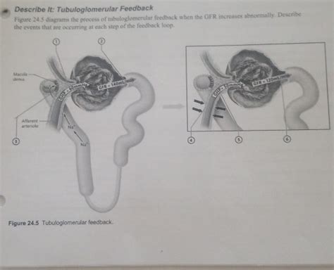 Solved Describe it: Tubuloglomerular Feedback Figure 245 | Chegg.com