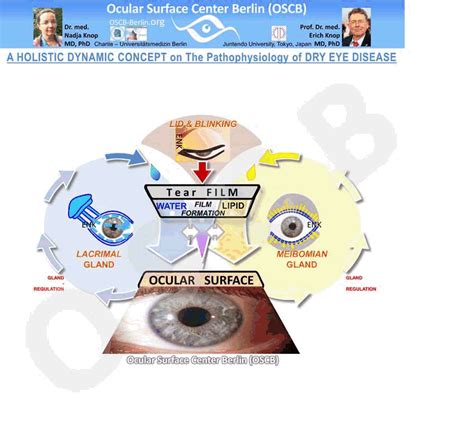 Dry Eye Concept 2 INTRO Ocular Surface Center Berlin