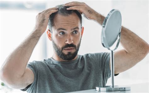 Traitements Anti Chute De Cheveux Chez L Homme Revivre Labs