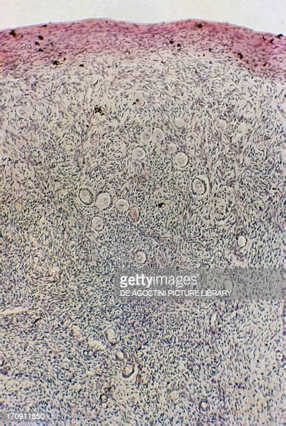 Ovary Pattern Photos And Premium High Res Pictures Getty Images