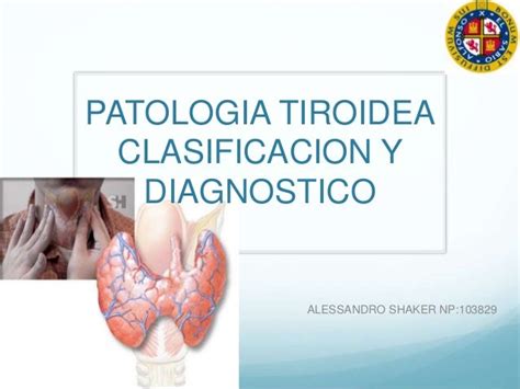 PatologÍa Tiroidea ClasificaciÓn