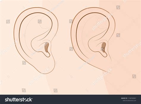 23 Attached Earlobe Images, Stock Photos & Vectors | Shutterstock