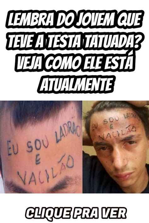 Lembra do jovem que teve a testa tatuada ladrão e vacilão Veja como